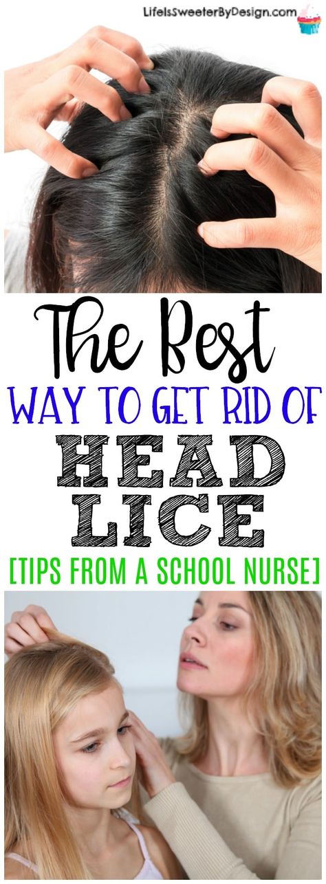 Home Lice Remedies, Natural Lice Remedies, Getting Rid Of Nits, Essential Oils For Lice, How To Treat Lice, Lice Nits, Lice Remedies, Lice Shampoo, Hair Lice