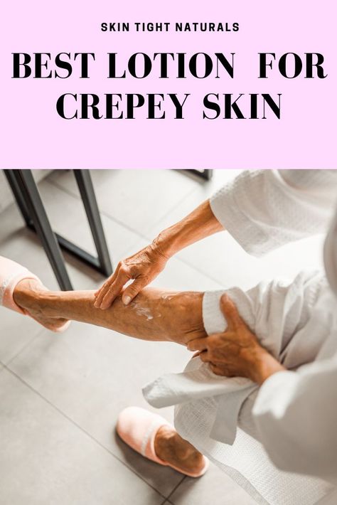 According to many dermatologists and plastic surgeons, crepey skin is very difficult to treat, but there are treatments like laser therapies and skin-tightening procedures. If you are opting to try a skincare procedure, make sure to do your research and use skincare products like lotions and creams that will help your treatments last longer and reverse crepey skin. Not sure what ingredients a good crepey skin lotion should have? Keep reading to find out. #crepeskinlotion #bestlotionfordryskin Crepy Skin, Shimmery Nails, Crepe Skin, Skin Tightening Procedures, Creepy Skin, Best Lotion, Crepey Skin, Lotion For Dry Skin, Saggy Skin