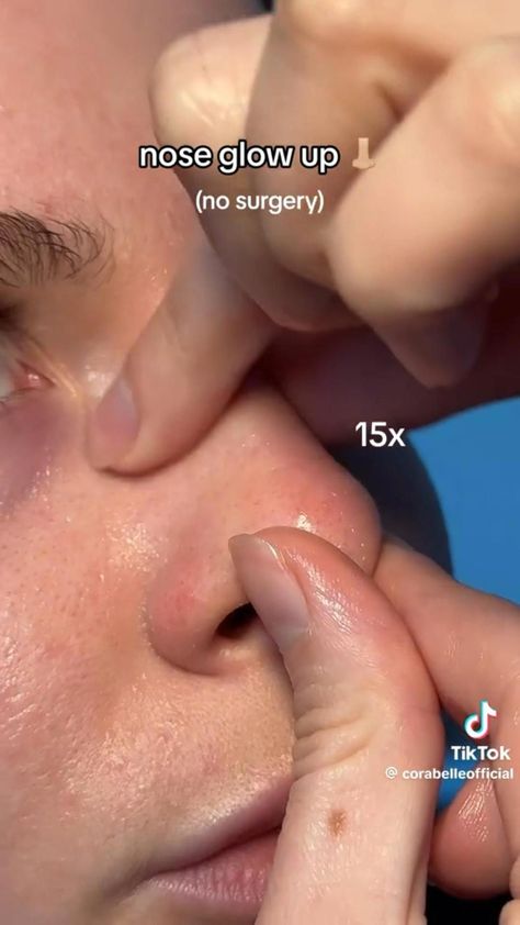 Perfect Nose Exercise, Nose Exercise, Yoga Information, Perfect Nose, Love Challenge, Wellness Routine, Shape Of You, Yoga Lifestyle, Tooth Decay