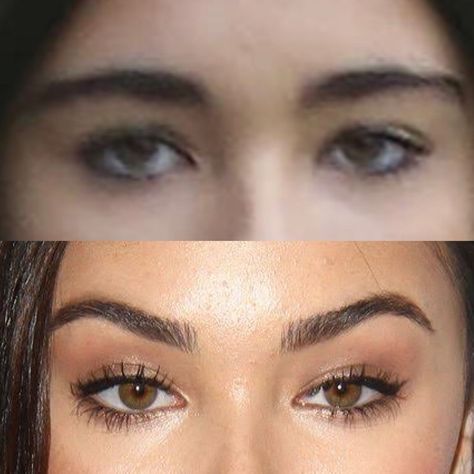 Madison Beer natural face and eyes before plastic surgery Eyebrow Botox Lift, Canthoplasty Before And After, Fox Eye Botox Before And After, Eye Surgery Before And After, Fox Eye Surgery Before And After, Fox Eye Lift Before And After, Madison Beer Eyes, Botox Eyebrow Lift Before And After, Eyebrow Lift Botox Before And After