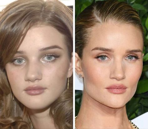 Nose Job Old Pics, Celebrity Plastic Surgery, Celebrities Before And After, Rosie Huntington, Before After Photo, Sofia Richie, Nose Job, Huntington Whiteley, Changing Jobs