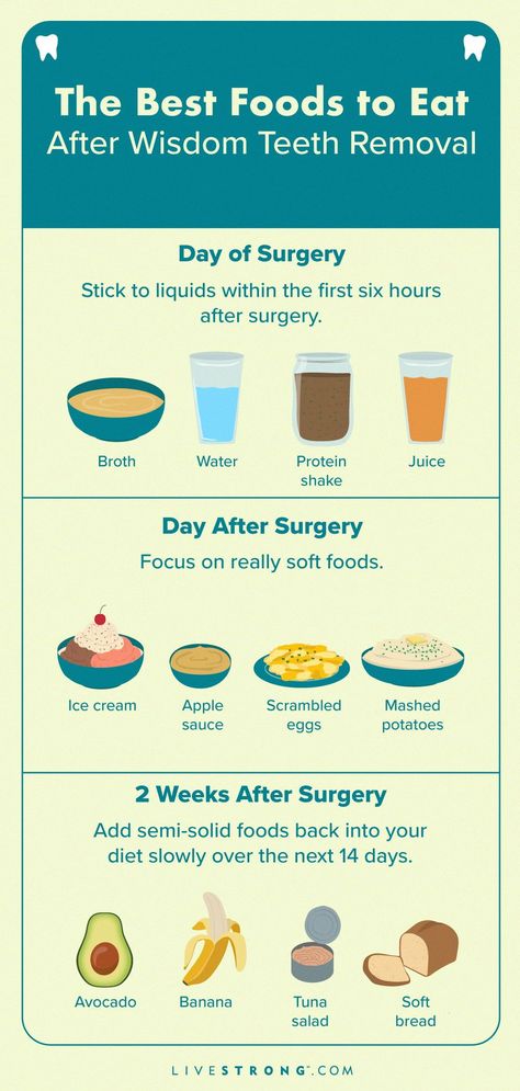 Post Wisdom Teeth Food, Wisdom Teeth Recovery Food, Wisdom Teeth Removal Food, Eating After Tooth Extraction, Wisdom Teeth Food, Wisdom Teeth Recovery, Soft Foods To Eat, After Wisdom Teeth Removal, Teeth Surgery