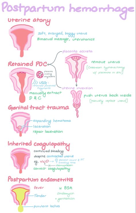 Obstetrics Nursing, Postpartum Hemorrhage, Nursing School Inspiration, Midwifery Student, Student Midwife, Nursing School Essential, Nursing School Motivation, Medical School Life, Nurse Study Notes