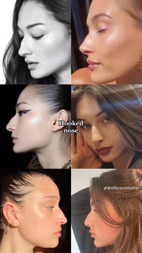 Plastic Surgery Fails, Models With Big Noses, Hooked Nose, Plastic Surgery Fail, Nose Types, Face Surgery, Plastic Surgery Gone Wrong, Big Nose Beauty, Pretty Nose