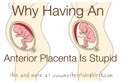 At my 20 week anatomy ultrasound appointment I asked the tech where my placenta was located.  She said I had an anterior placenta, to which I replied, "that's stupid." The ultrasound tech wondered ... 19 Weeks Pregnant Belly, Anterior Placenta, 19 Weeks Pregnant, 20 Weeks Pregnant, Annoying Things, Ultrasound Tech, Hippie Baby, Postpartum Doula, Things That Go