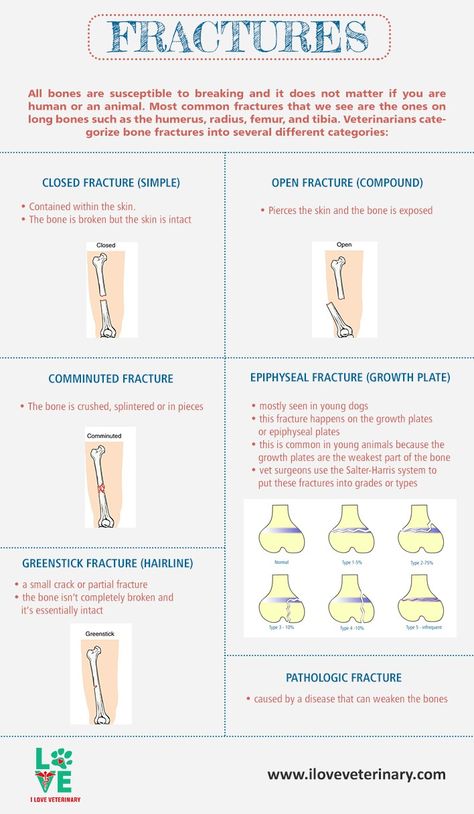 Types of Bone Fractures Veterinary Infographics, Vet Nursing, Types Of Fractures, Emt Study, Biochemistry Notes, Vet Tech School, Nursing Journal, Vet Tech Student, Vet Technician