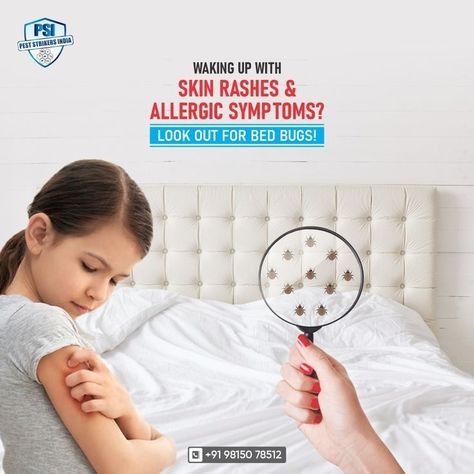 Get Rid Of Bed Bugs, Cockroach Control, Rid Of Bed Bugs, Skin Rashes, Rodent Control, Mosquito Control, Termite Control, Bed Bug, Nail Care Routine