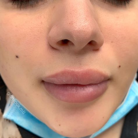 Cute Face Moles, Face Mole Tattoo Beauty Marks, Face Moles Beauty Marks Aesthetic, Cute Moles On Face Aesthetic, Mole Above Lip Beauty Marks, Beauty Spot Tattoo Face, Beauty Moles On Face, Women With Moles On Face, Beauty Moles Aesthetic