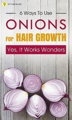 Onions For Hair Growth, Onion Hair Growth, Onion Juice For Hair, Help Hair Growth, Onion For Hair, Onion Juice, Boost Hair Growth, Grow Hair Faster, For Hair Growth