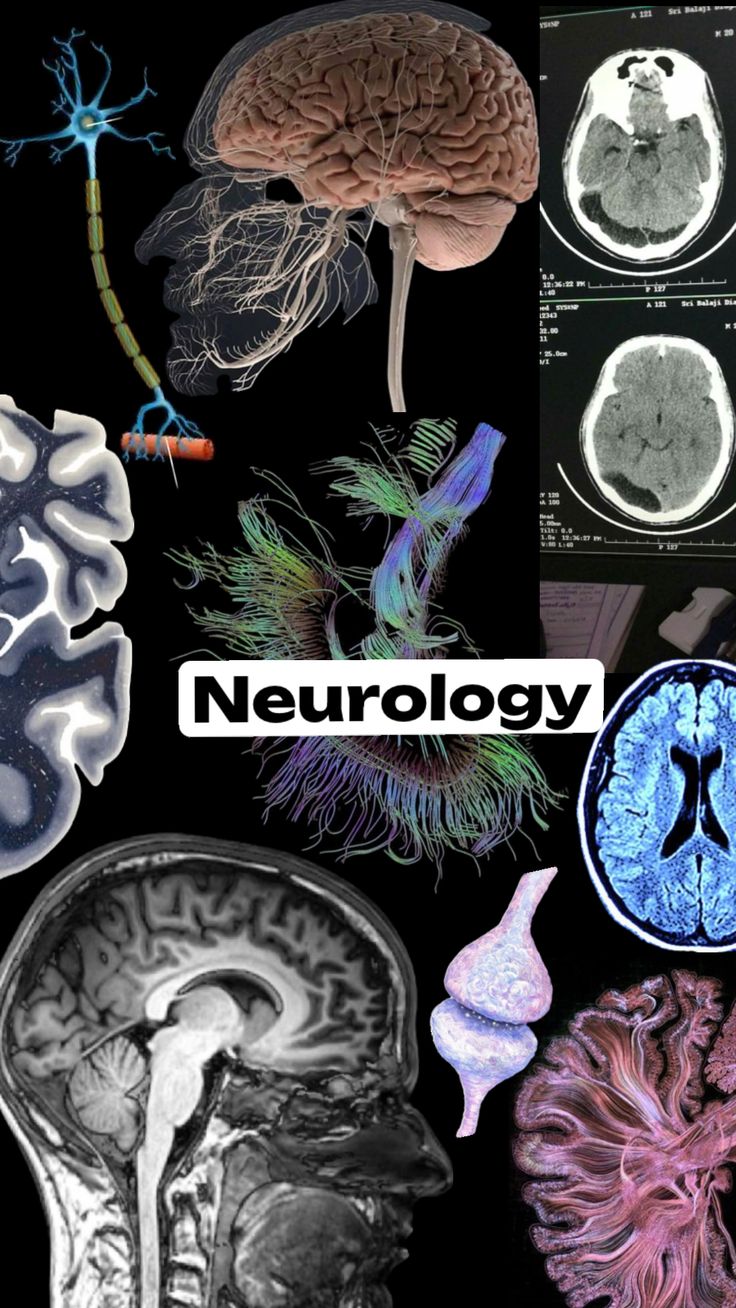 an image of neurology in the brain