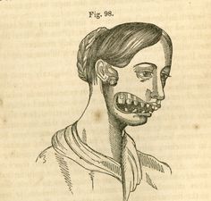 an old book with a drawing of a woman's face and teeth on it