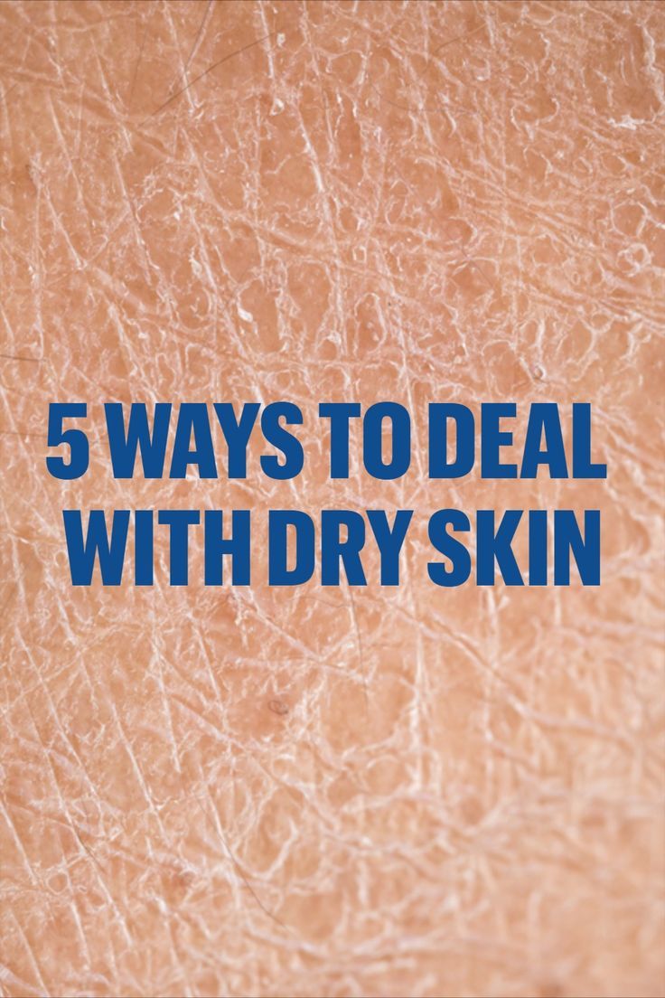 What To Do For Dry Skin, Dryness On Face, How To Help Dry Skin On Your Face, How To Remove Dry Skin From Face, How To Remove Dryness From Face, Dry Skin On Body Remedies, Best Soap For Dry Skin, How To Get Rid Of Dry Skin, How To Treat Dry Skin On Face