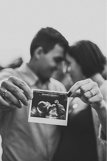 a man and woman holding up an x - ray photo