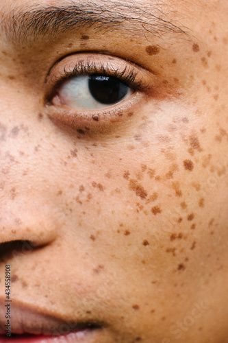 Stock Image: Close up portrait of girl with freckles Face With Freckles, Zoomed In Face, Close Up Photography Face Black Women, Woman With Freckles, Clear Skin With Freckles Aethstetic, Freckle Portrait Photography, Freckle Photography, Freckles Girl, Freckle Face