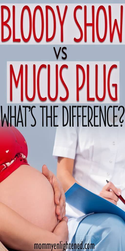 Have you ever wondered what the difference was between bloody show and your mucus plug? If you are preparing for a newborn baby, this is definitely something you want to understand in your pregnancy prior to going into labor. Good luck! #mommyenlighetned Mucous Plug, Going Into Labor, Labor Pain Management, Mucus Plug, Third Pregnancy, Cute Pregnancy Announcement, Pregnancy Info, Birthing Classes, Pregnancy Essentials