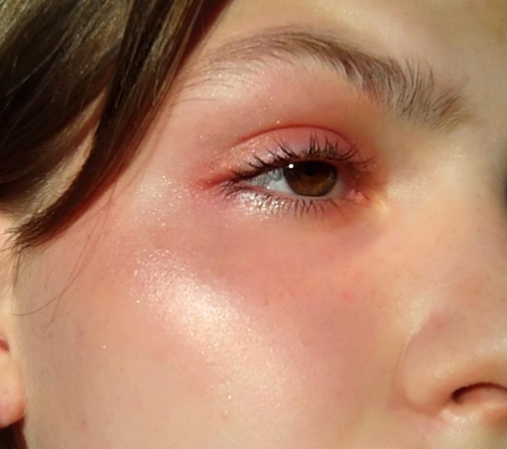 Pink Eyeshadow With Blue Eyes, Rosey Cheeks Makeup, Coral Blush Makeup, Coral Makeup Looks, Under Eye Blush, Peach Blush Makeup, Coral Eye Makeup, Peach Makeup Look, Playful Makeup