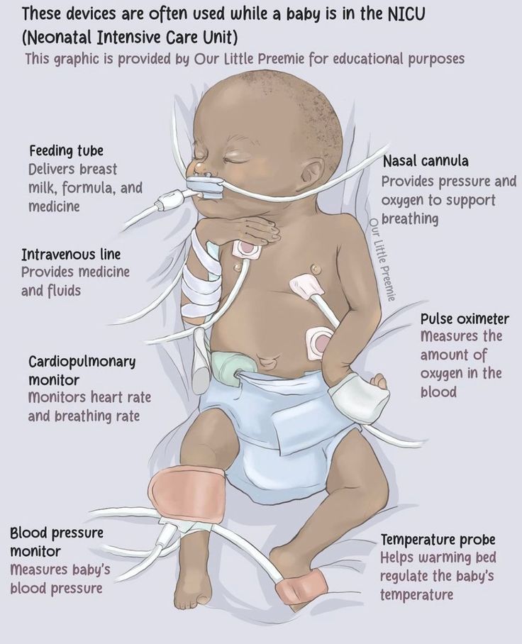 a baby with an inhaler attached to it's stomach and the words