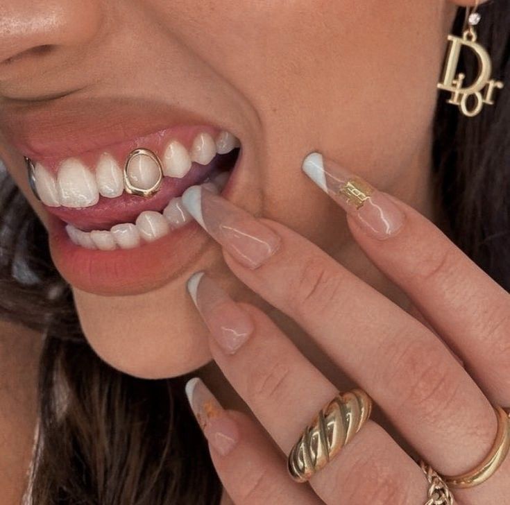 Girls With Grills, Gold Tooth Cap, Girl Grillz, Teeth Aesthetic, Pretty Teeth, Dental Jewelry, Grillz Teeth, Teeth Caps, Diamond Grillz