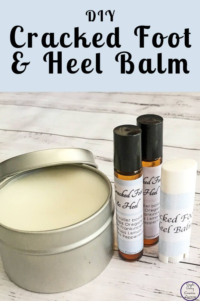 Heel Balm, Making Cosmetics, Salve Recipes, Cracked Hands, Diy Lotion, Creme Anti Age, Homemade Lotion, Diy Kosmetik, Diy Body Care