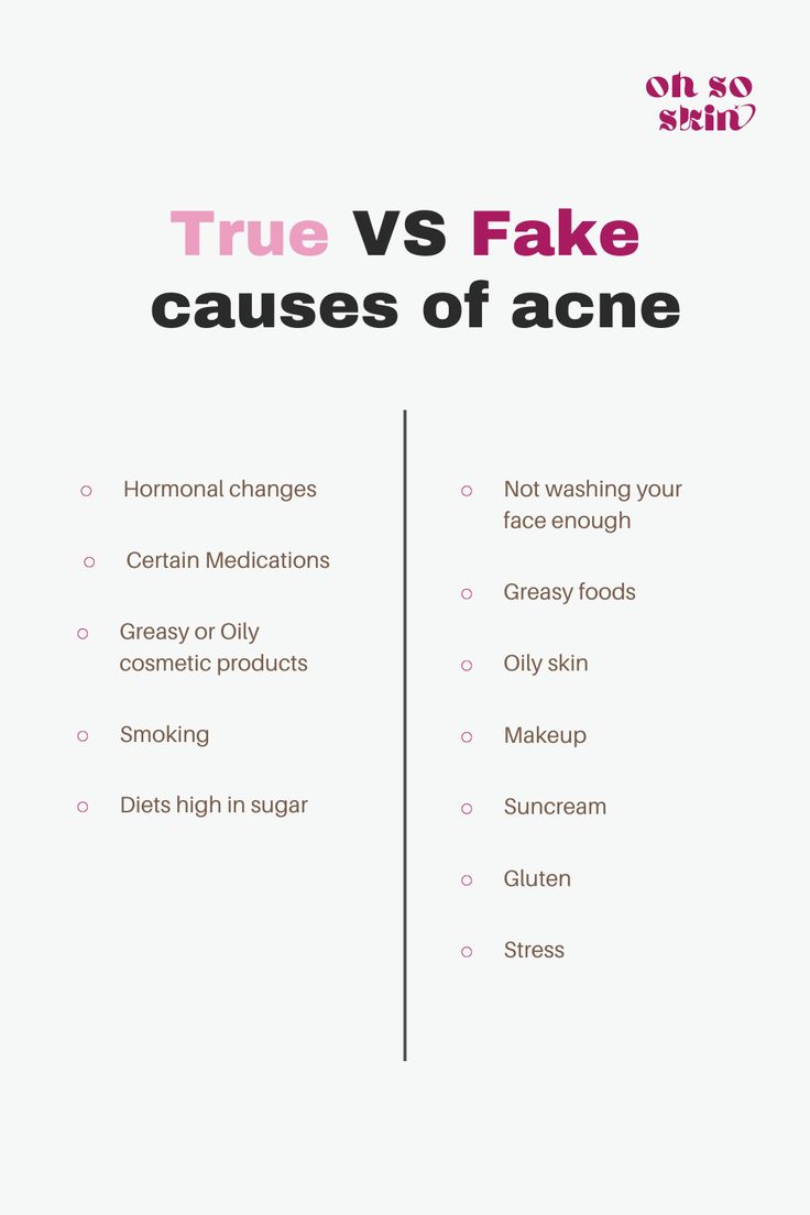 There are many myths around acne, what causes it and how to treat it especially. Here are some of the actual causes of acne, along with some myths to not believe. #skincare #acne #causesofacne #treatacne Skin Knowledge, Acne Prone Skin Care Routine, Causes Of Acne, Different Types Of Acne, Face Mapping Acne, Acne Prone Skin Care, Teen Skincare, Bad Acne, Skincare Acne