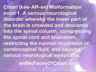 September is Chiari Malformation Awareness Month. 💜  #ChiariAwareness Chiari Malformation Facts, Chiari Malformation Surgery, Chari Malformation, Migraine Journal, Chiari Warrior, Dysautonomia Pots, Doctor Hospital, Chiari Malformation, Spina Bifida