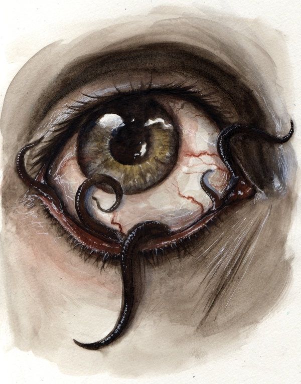 an eye that has some kind of strange thing in it's irise, and is