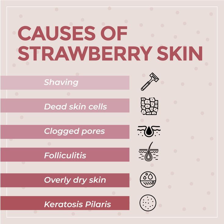 Strawberry Arms, Skin Chart, Spa Ceylon, Strawberry Skin, Skin Anatomy, Youtube Aesthetic, Blind Pimple, Pimples Under The Skin, Skincare Advice