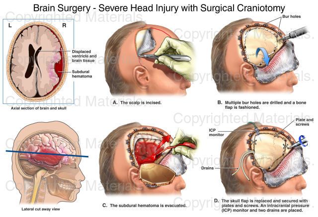 medical diagrams showing the location of the doctor's stock