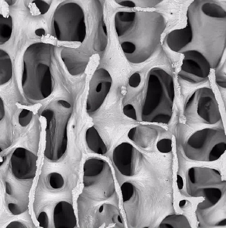 the structure of an animal's bone is shown in black and white, with holes on