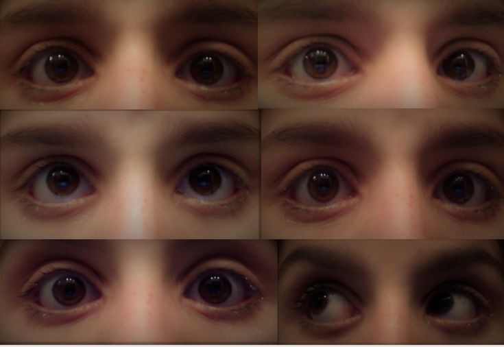 multiple images of an eye with different angles