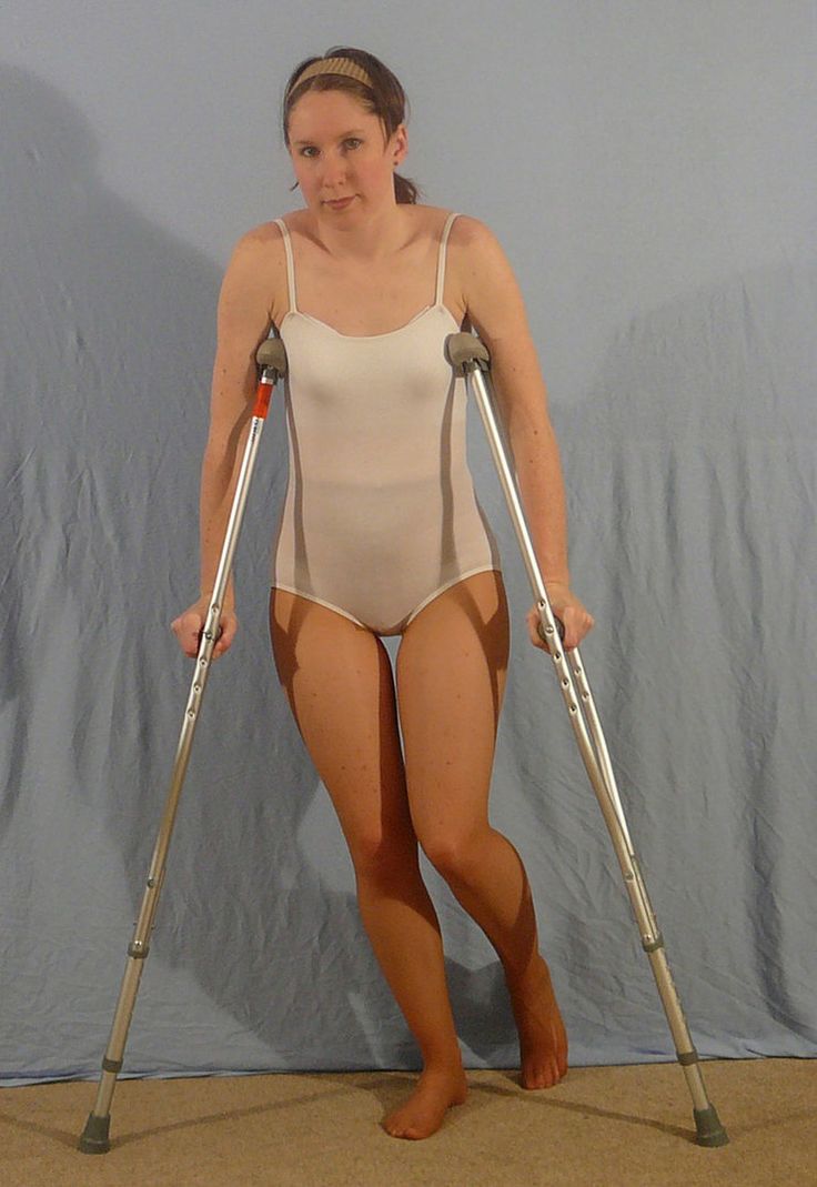 a woman with crutches standing in front of a blue wall wearing a white bodysuit