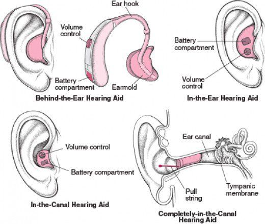 This article reviews the process of getting hearing aids and what to expect along the way Deaf Awareness, Deaf Education, Hearing Health, Deaf Culture, Health Guru, Cochlear Implant, Speech Therapy Resources, Speech Language Pathology, Hearing Loss