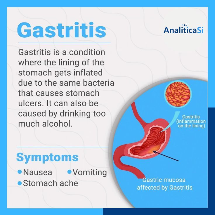 What causes gastritis? Thyroid Vitamins, Stomach Remedies, Diagnostic Centre, Gastric Problem, Medical Diagnosis, Diy Medicine, Bells Palsy, Pathology Lab, Gastrointestinal Disease