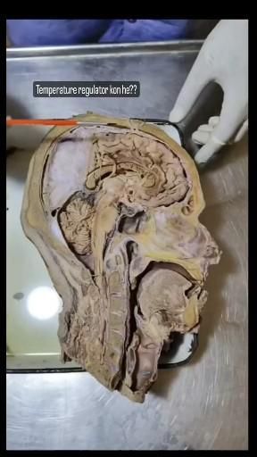 Brain Brain Parts And Functions, Brain Parts, Medical School Life, Basic Anatomy And Physiology, Medical Student Motivation, Medical Videos, Medical Student Study, Biology Facts, Brain Anatomy