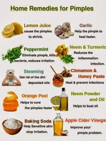 Home remedies for pimples. Bumps On Face, Small Bumps On Face, Remedies For Pimples, Severe Acne Remedies, Natural Remedies For Sunburn, Remedies For Acne, Home Remedies For Pimples, Sunburn Remedies, Skin Natural Remedies