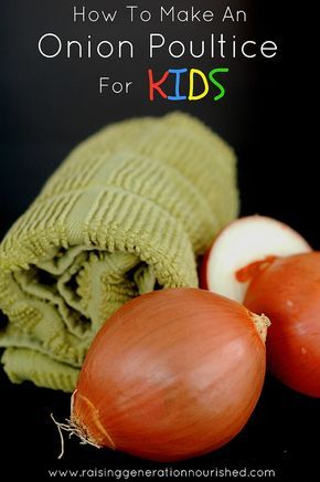 How To Make An Onion Poultice For Kids - Raising Generation Nourished Also works for ear ache by placing poultice behind affected ear. Onion Poultice, Cough Remedies For Kids, Chest Congestion Remedies, Cold And Cough Remedies, Sick Remedies, Great Grandparents, Chest Congestion, Home Remedy For Cough, Cold Sores Remedies