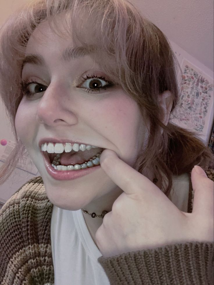 a woman with braces and piercings on her teeth