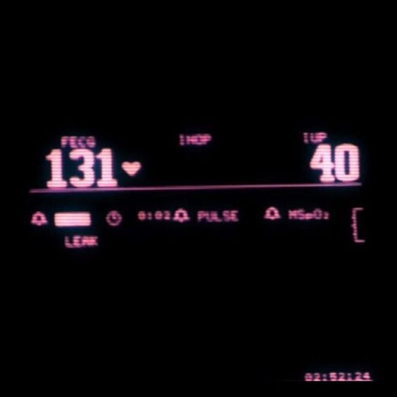 the speedometer is displayed in pink and black