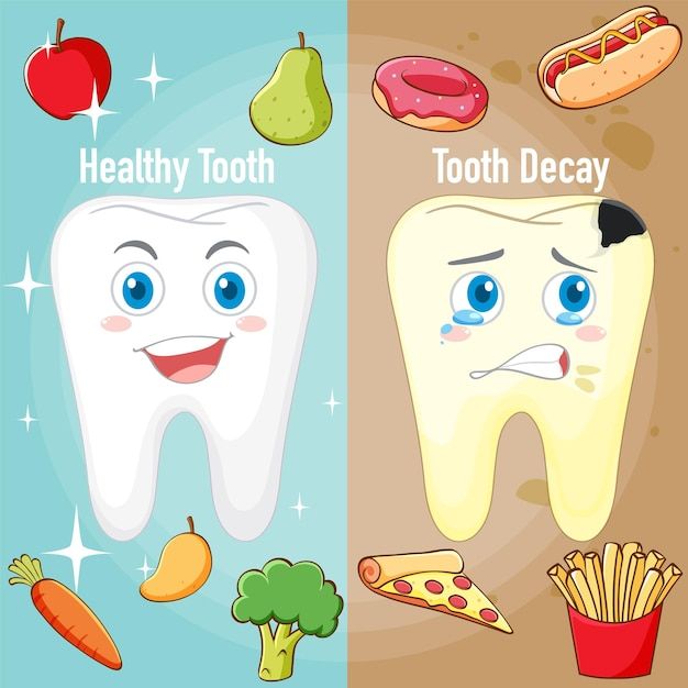 Tooth Decay Cartoon, Food For Healthy Teeth, Dental Sayings, Dental Cartoon, Tooth Template, Teeth Poster, Dentist Cartoon, Cartoon Tooth, Dental Quotes