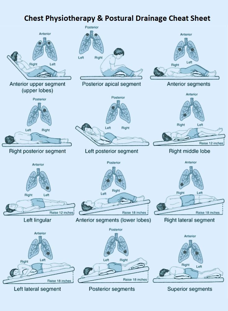 Postural Drainage Positions and Chest Physiotherapy (CPT) Study Guide Postural Drainage and Chest Physiotherapy (CPT) are types of Airway Clearance Therapy. This study guide will help you learn the Postural Drainage Positions. Mucus Clearing Techniques That Alleviate Shortness of Breath Mucus can result in difficulty breathing and shortness of breath. Read these helpful tips for clearing mucus and breathing easier Chest Physiotherapy, Postural Drainage, Physiotherapy Student, Physical Therapy School, Medical Assistant Student, Natural Decongestant, Medical Drawings, Bad Cough, Physical Therapy Student