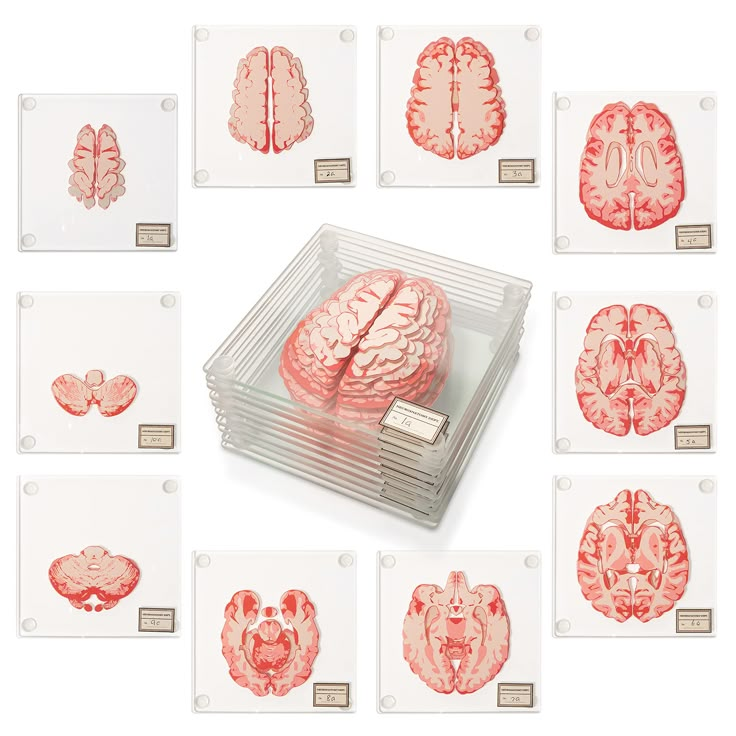 several images of the human brain in various stages of development