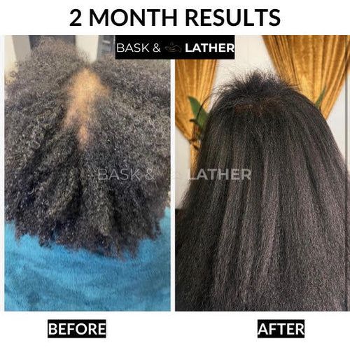 Healthy Hair Starter Kit | Essentials for Healthy Hair Routine Scalp Stimulator, Get Healthy Hair, Hair Growth Journey, Hair Growth Products, Healthy Hair Routine, Hair Elixir, Hair Balm, How To Grow Natural Hair, Healthy Hair Care