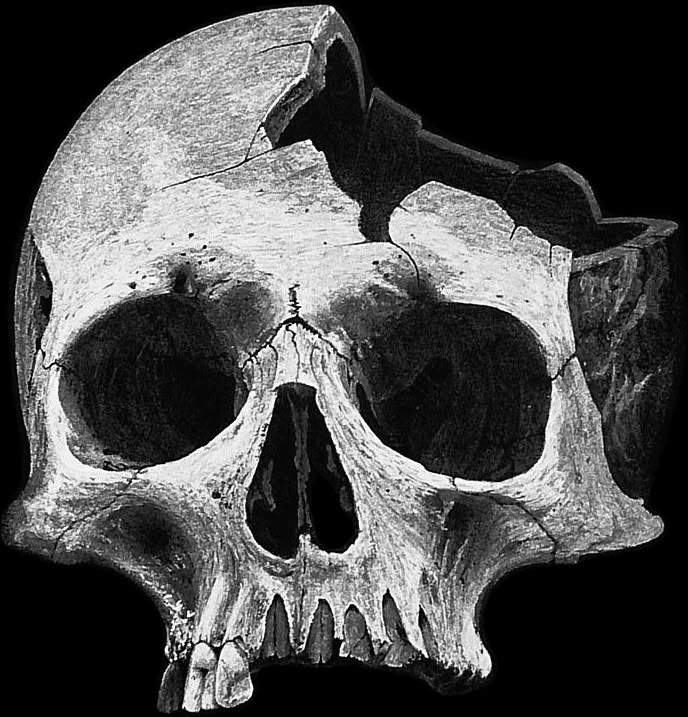 a black and white photo of a human skull