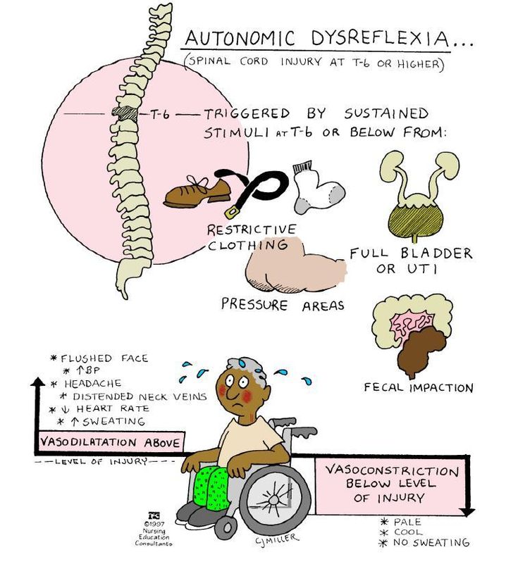 an image of the anatomy of a person in a wheel chair