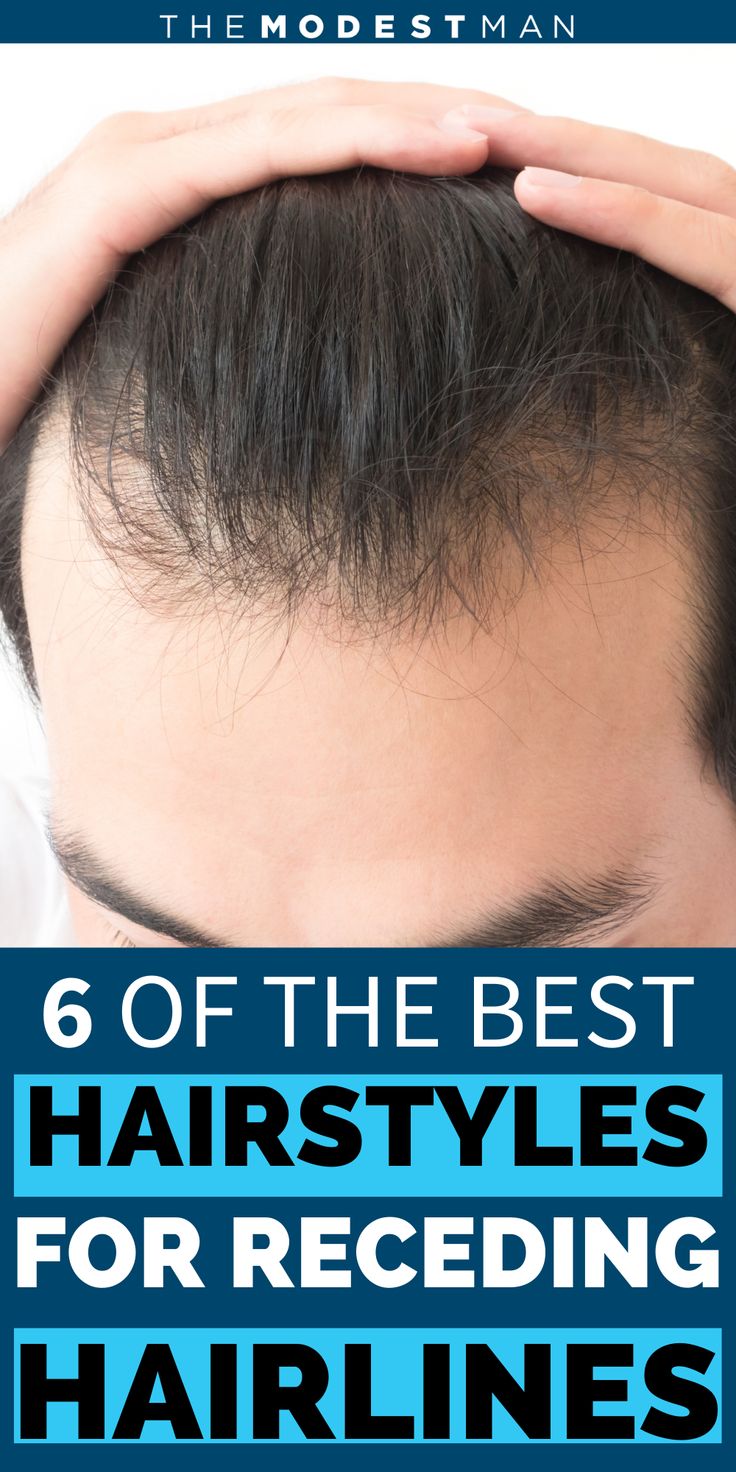 Men Thinning Haircut, Men Receding Hairline Hairstyles, Haircut For Men With Big Foreheads, Haïr Style For Men, Hairstyles For Men With Receding Hair, Men High Fade Haircut, Hairstyle For Receding Hairline Mens, Men’s Short Hairstyles Receding Hairline, Mens Hairstyles Receding Hairline