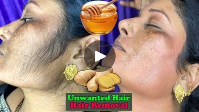 1.1M views · 8.9K reactions | Stop shaving! It's the easiest recipe to remove facial and body hair without any pain | shaving, recipe, facial | Permanent Hair Removal Cream At Home - No Wax No Pain - Get rid of unwanted facial and body hair | By Simple Home Remedies | Facebook Waxing Vs Shaving, Stop Shaving, Natural Hair Removal Remedies, Permanent Hair Removal Cream, Lip Hair Removal, Unwanted Hair Permanently, Permanent Hair Removal, Underarm Hair Removal, Hair Removal Permanent