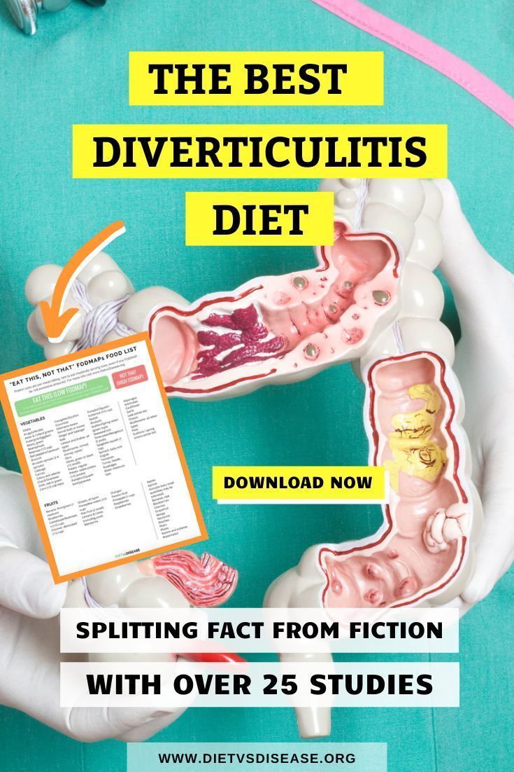 Do you have diverticulitis? Read the last article where I explain what is diverticulitis diet, how to treat flare up, adjust your medication and supplements, foods to avoid and so much more! I also answer if you should do FODMAP diet and give your a sample recipe meal plan that you can print out as your grocery shopping list. Dietitian Nutrition Science Education Facts | Simple Diet Plan Menu Ideas | Symptoms Healthy Living | Holistic Health And Fitness | Health Coach Nutritionist Tips Website Diviticulitis Diet, Nutrition Science, Easy Diet Plan, Best Diet, Food Intolerance, Fodmap Diet, Diet Menu, Nutrition Education, Foods To Avoid