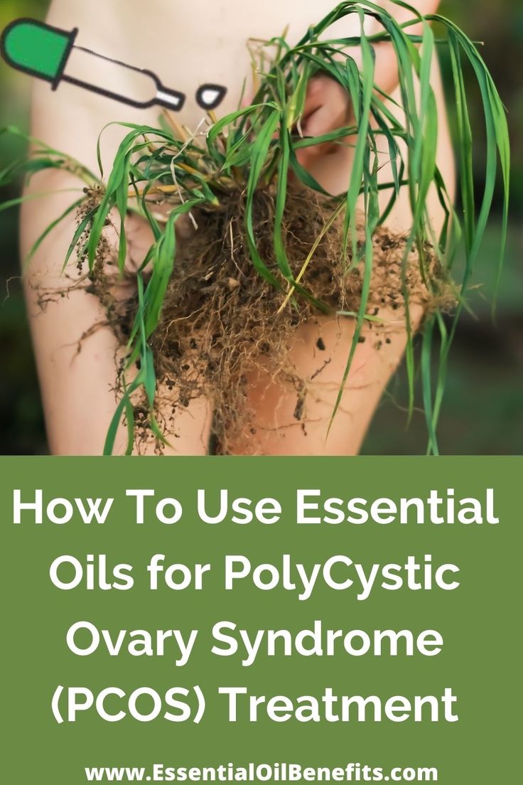 How To Use Essential Oils for PolyCystic Ovary Syndrome (PCOS) Treatment #PCOS #EssentialOils #EssentialOilsBenefits #EssentialOilsUses #EssentialOilsBlends #NaturalHealing #HomeRemedies Wellness Board, Natural Remedies For Allergies, Womens Health Care, Polycystic Ovaries, Natural Health Care, Essential Oil Benefits, Herbal Healing, Healing Oils, Natural Health Tips