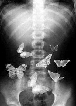 an x - ray shows butterflies flying in the air