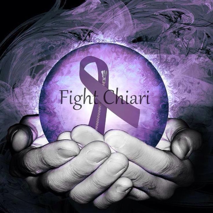 September is Chiari Malformation Awareness Month. Chari Malformation, Chiari Warrior, Osgood Schlatter Disease, Warrior Wallpaper, Dog Skull, Chiari Malformation, Waterslide Decal Paper, Cerebrospinal Fluid, Brain Surgery